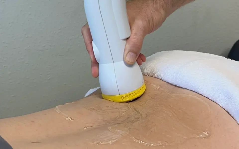 Close-up of the SoftWave applicator on a patient’s lower back with conductive gel