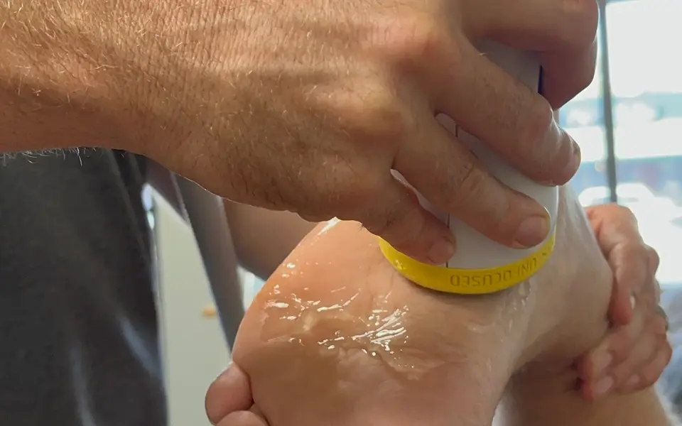 SoftWave applicator treating the heel and arch of a patient’s foot