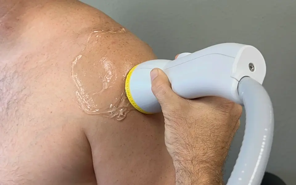 SoftWave applicator treating a patient’s shoulder
